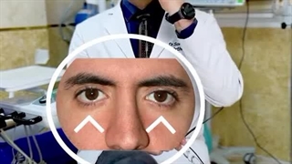 چگونه با ارتودنسی گونه های برجسته داشته باشیم؟