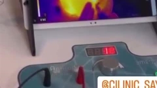 لیفتینگ و جوانسازی پوست با دستگاه پزشکی Aphrodite