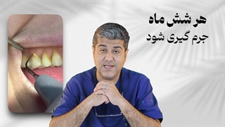 چرا بعضیا هر چی می‌خورن، دندوناشون خراب نمیشه؟! راز دندونای ضد پوسیدگی!