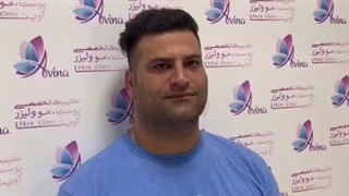 کاشت مو در کلینیک آوینا