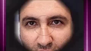 کاشت مو در کلینیک آوینا
