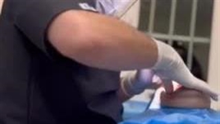 مشاوره و ویزیت جهت ایمپلنت دندان در قیطریه