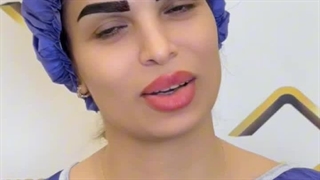 لیزر تراپی سرد کاشتهای ابرو در کلینیک تخصصی رنسانس