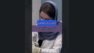 نتیجه شگفت انگیز خالبرداری تخصصی توسط دکتر پریسا ذبیحی در زیبایی چهره