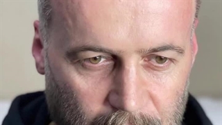 کلینیک تخصصی کاشت مو رشت