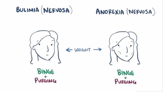 Bulimia nervosa
