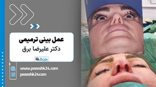 ترمیم بینی دکتر علیرضا برق در تهران - پزشک 24