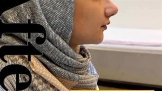 دو سال پس از جراحی بینی