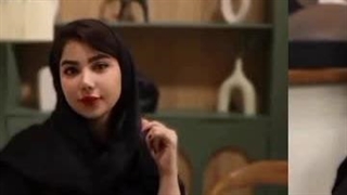 8 ماه پس از جراحی بینی