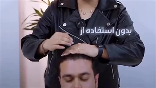 کاشت مو تانیا