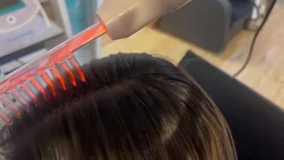 تقویت ساقه و ریشه مو با استفاده از پلاسماتراپی