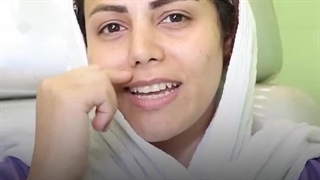 عمل بینی ترمیمی بدون بیهوشی در درمانگاه مسیح