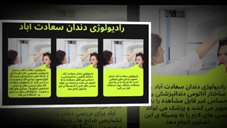 رادیولوژی دندان سعادت آباد برای تشخیص کامل