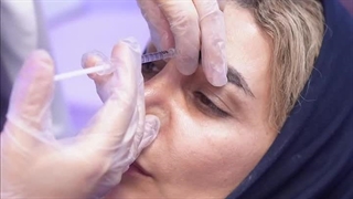 تزریق ژل و‌ بوتاکس در کلینیک آوینا