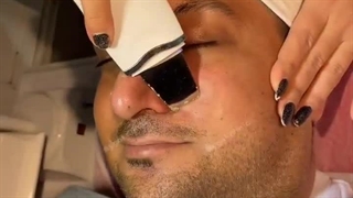 فیشیال مخصوص پوست‌های مستعد جوش | آی گل