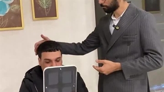 نمونه کاشت موفق مو