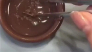 پروتز دندان