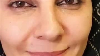 نمونه بوتاکس دکتر آرین گودرزی