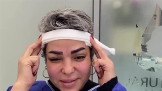 فیلم رضایت کاشت ابرو طبیعی