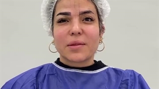 رضایت زیباجوی از کاشت ابرو