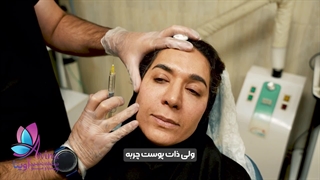مزوژل در کلینیک آوینا