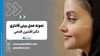 نمونه عمل بینی فانتزی دکتر افشین فتحی در تهران - پزشک 24