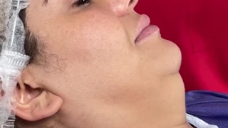 خداحافظی با غبغب