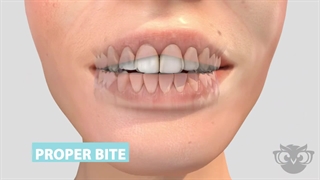 ارتودنسی متحرک