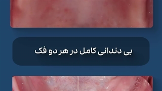 موشن گرافی سه بعدی دندانپزشکی | بیاسا