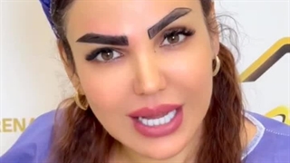 اصلاح فرم ابرو به روش میکرو sut در کلینیک زیبایی رنسانس