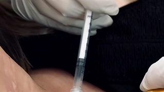 تزریق جوانساز گردن