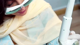 لیزر فوتونا برای جوانسازی صورت