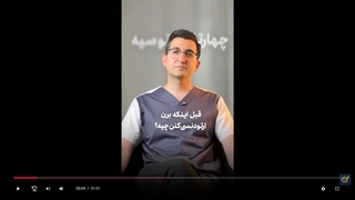 4 توصیه قبل از اینکه ارتودنسی رو شروع کنید