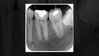 خدمات رادیولوژی در مرکز رادیولوژی فک و صورت سعادت آباد : مرکز رادیولوژی تخصصی دکتر نکیسا ایل