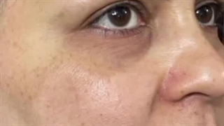 کرم معجزه سفید کننده صورت