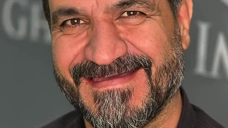 قبل و بعد نمونه کار ایمپلنت کل دهان