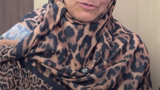 درمان آرتروز انگشت با طب سنتی