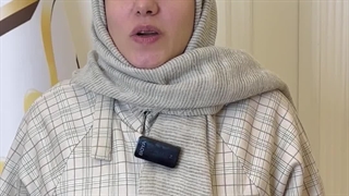 نتیجه کاشت ابرو بعد از 3 سال در کلینیک رنسانس