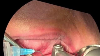 جراحی و کاشت ایمپلنت به صورت تخصصی در تهران توسط دکتر حمید پورصادقی