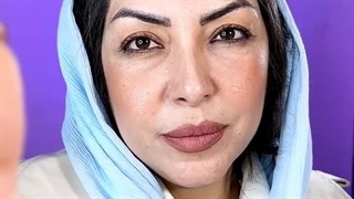 ویدیو قبل و بعد کاشت ابرو جذاب و دیدنی در کلینیک آفرینش