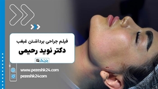 فیلم برداشتن غبغب در مشهد دکتر نوید رحیمی زارعی- پزشک 24