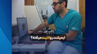سیگار و مصرف دخانیات باعث نابودی ایمپلنت میشه !؟