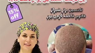 کاشت مو