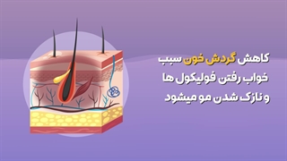 درمان ریزش مو