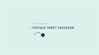 1 Anal Fistulotomy