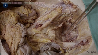 7 Anatomy - Rectum