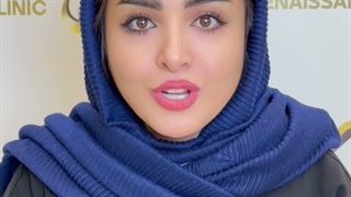 نتیجه کاشت ابرو بعد از 6 سال در کلینیک سینا همان رنسانس معروف