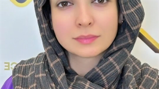 کاشت ابروی سوپرنچرال با 5 زاویه طبیعی