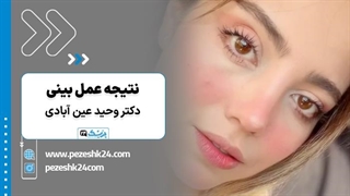 نمونه واقعی عمل بینی گوشتی در شیراز با نتیجه طبیعی - پزشک 24