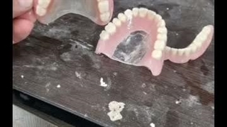 لابراتور دندانسازی سپید در لنگرود